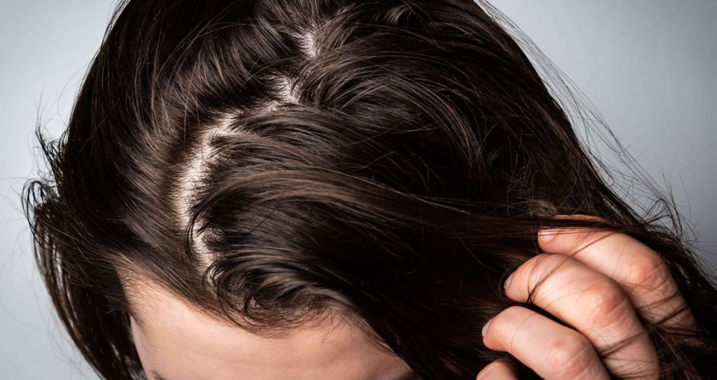 علت چرب شدن مو چیست؟